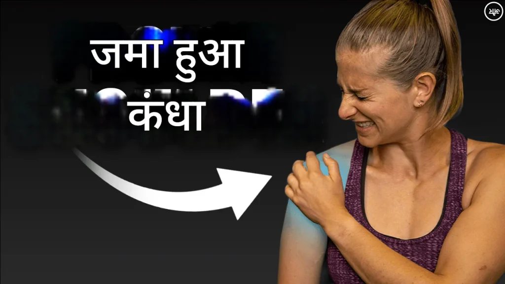 जमे हुए कंधे