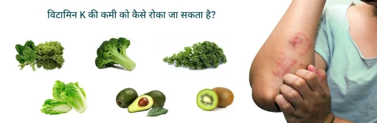 विटामिन के की कमी