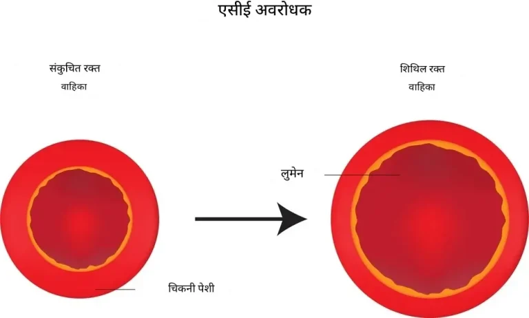 ACE इन्हिबिटर्स