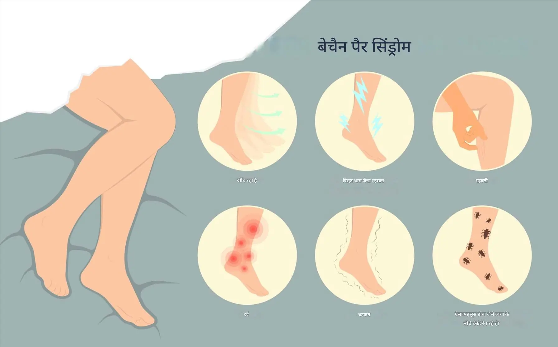 रेस्टलेस लेग्स सिंड्रोम