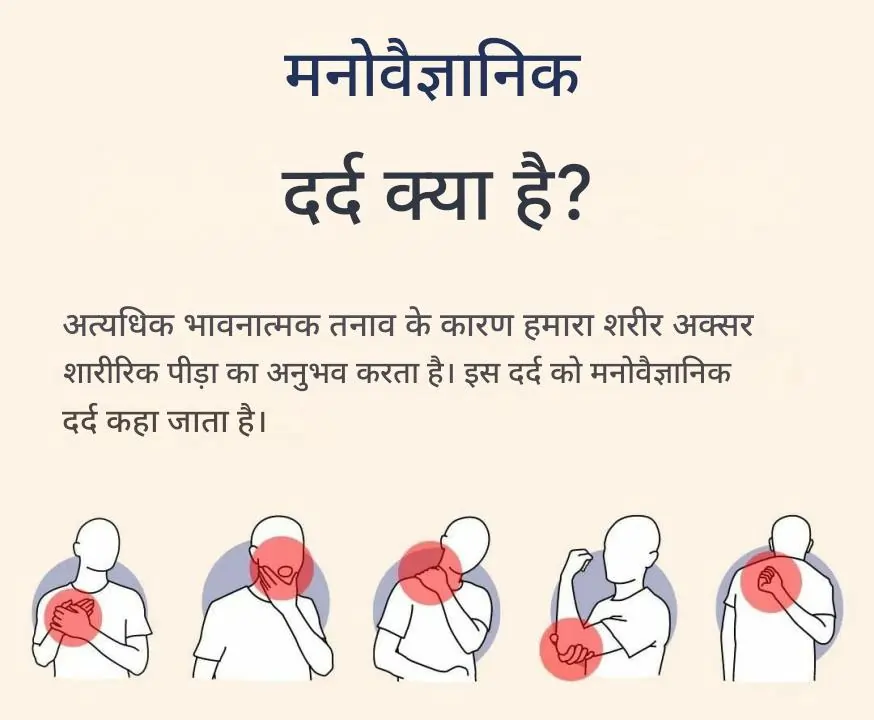 साइकोजेनिक दर्द