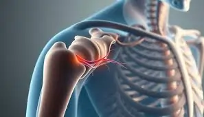 कंधे की नस दबने से क्या होता है