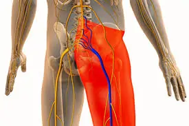 सिहाटी (sciatica): कारण, लक्षण, और फिजियोथेरेपी उपचार