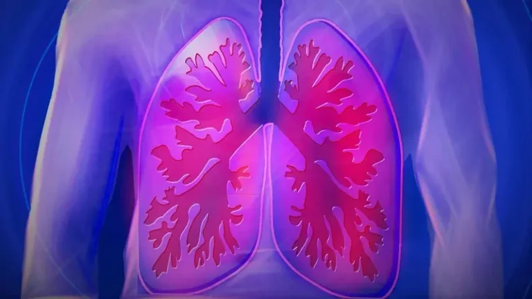 COPD / फेफड़ों की समस्या में फिजियोथेरेपी स्ट्रैटेजी