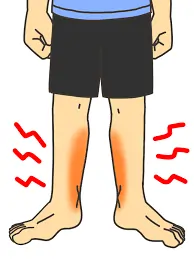 पैर की थकावट (Leg fatigue) कैसे कम करें