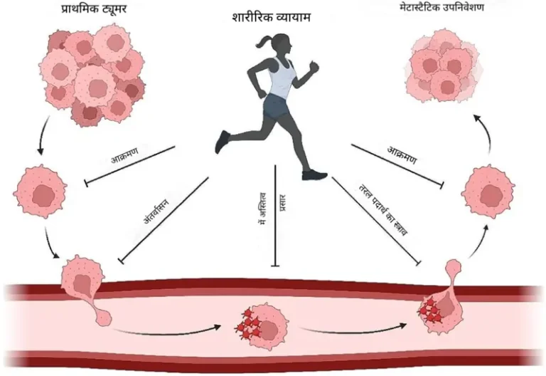 वजन थेरापी (Weight therapy) की शुरुआत और प्रगति
