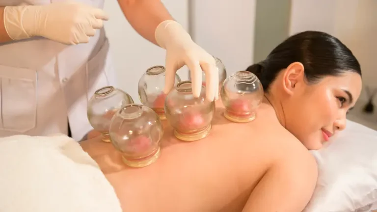 कपिंग थेरेपी (Cupping Therapy) के वैज्ञानिक प्रमाण।