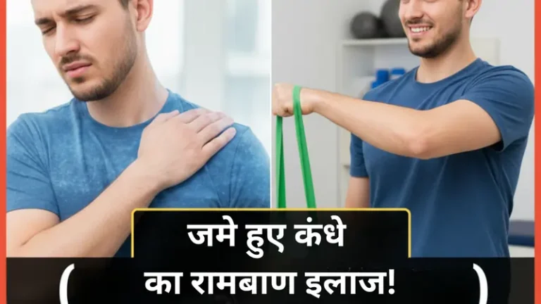 जमे हुए कंधे का इलाज