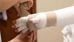 लिम्फेडेमा (Lymphedema) का प्रबंधन