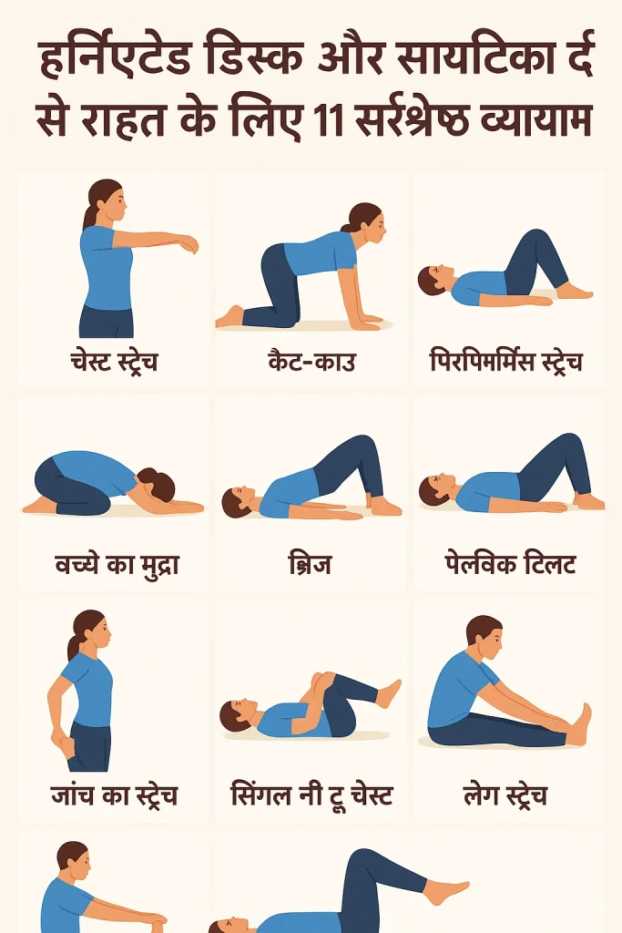 हर्निएटेड डिस्क और साइटिका दर्द से राहत के लिए 11 सर्वश्रेष्ठ व्यायाम