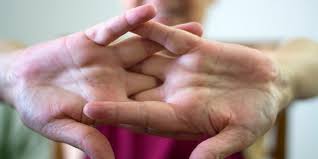 क्या क्रैकिंग (हड्डियां चटकाने) से आर्थराइटिस (गठिया) होता है?