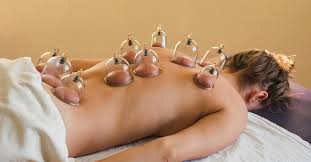 क्यूपिंग थेरेपी (Cupping Therapy): खिलाड़ियों के बीच रिकवरी के लिए इसकी बढ़ती लोकप्रियता