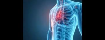 गुलियन बेरे सिंड्रोम (GBS) के बाद मांसपेशियों की ताकत वापस लाने की प्रक्रिया