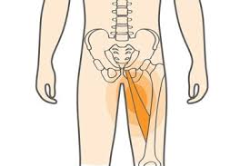 ग्रोइन स्ट्रेन (Groin Strain)