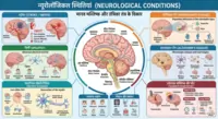 न्यूरोलॉजिकल स्थितियां (Neurological Conditions)