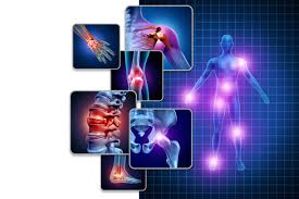 फाइब्रोमायल्गिया (Fibromyalgia): पूरे शरीर में तेज दर्द के कारण और फिजियोथेरेपी