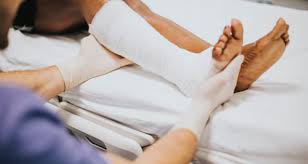 फैक्चर (हड्डी टूटने) के बाद हड्डी जुड़ने की प्रक्रिया को तेज करने वाले पोषक तत्व