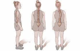 मस्कुलर डिस्ट्रॉफी (Muscular Dystrophy): मांसपेशियों के कमजोर होने की बीमारी का रिहैब