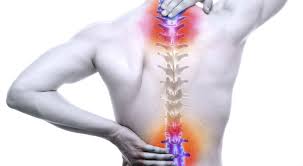 लंबर स्पोंडिलोसिस