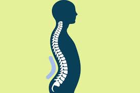 लॉर्डोसिस (Lordosis): कमर के निचले हिस्से में ज्यादा कर्व (गड्ढा) होने के नुकसान