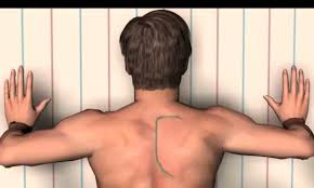 विंगिंग ऑफ स्कैपुला (Winging of Scapula): कंधे की हड्डी बाहर निकलने का कारण और इलाज