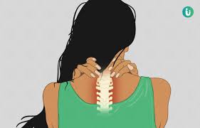 सर्वाइकल स्पोंडिलोसिस