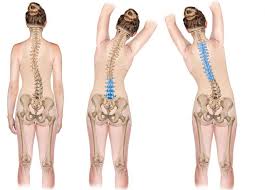 स्कोलियोसिस (Scoliosis): रीढ़ की हड्डी के टेढ़ेपन को रोकने के सरल व्यायाम