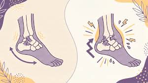 एंकल स्प्रेन (टखने की मोच): R.I.C.E. प्रोटोकॉल और टखने की मजबूती के लिए बैलेंस ट्रेनिंग