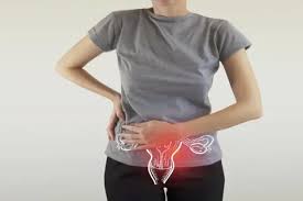 एंडोमेट्रियोसिस (Endometriosis) के कारण होने वाले पेल्विक और कमर दर्द का इलाज
