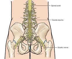 कौडा इक्विना सिंड्रोम (Cauda Equina Syndrome): स्पाइन की वह खतरनाक स्थिति जिसमें तुरंत सर्जरी जरूरी है