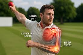 क्रिकेट के शौकीनों के लिए: 'थ्रोइंग इंजरी' (कंधे का दर्द) का बिना सर्जरी फिजियोथेरेपी प्रबंधन