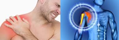 क्रिकेटर्स में फास्ट बॉलिंग करते समय पीठ और कंधे की चोट की रोकथाम