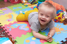 डाउन सिंड्रोम (Down Syndrome) वाले बच्चों के लिए लो मसल टोन (Hypotonia) की फिजियोथेरेपी
