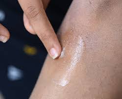 दर्द निवारक मलहम (Sprays-Ointments) और फिजियोथेरेपी क्या केवल मलहम से दर्द जड़ से जाता है