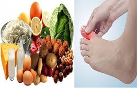 पारंपरिक खानपान (जैसे खमन, दाल) और यूरिक एसिड: गाउट के मरीजों को डाइट में क्या ध्यान रखना चाहिए?