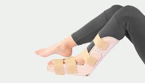 फुट ड्रॉप (Foot Drop) के लिए AFO (Ankle Foot Orthosis) स्प्लिंट का सही उपयोग