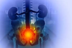 बढ़ती उम्र में प्रोस्टेट या पेल्विक कमजोरी के कारण यूरिन कंट्रोल खोने की समस्या के व्यायाम