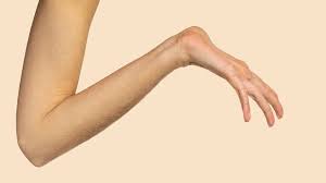 मार्फन सिंड्रोम: लंबे और लचीले अंगों वाले मरीजों में हृदय और स्पाइन की सुरक्षा