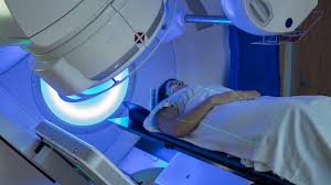 रेडिएशन थेरेपी के बाद त्वचा और आसपास की मांसपेशियों के सख्त होने (Radiation Fibrosis) का फिजियो इलाज