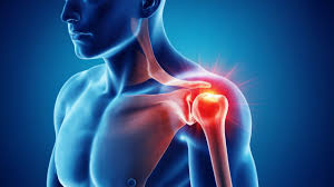 रोटेटर कफ इंजरी: जिम में भारी वजन उठाते समय कंधे की चोट के कारण और इलाज