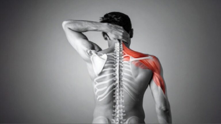 विटामिन डी की कमी से होने वाला हड्डी का दर्द (Osteomalacia) और धूप सेंकने का सही समय