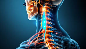 सर्वाइकल मायलोपैथी: जब गर्दन की नस दबने से हाथों की ग्रिप कमजोर होने लगे (जैसे शर्ट के बटन बंद न कर पाना)