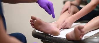 सेवर रोग (Sever's Disease): फुटबॉल या क्रिकेट खेलने वाले बच्चों की एड़ी में दर्द का इलाज