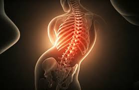 स्कोलियोसिस (टेढ़ी रीढ़) के मरीज क्या एक सामान्य और दर्द-मुक्त जीवन जी सकते हैं?