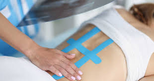 स्पोर्ट्स टेपिंग (Kinesiology Taping) क्या है और यह एथलीट्स के दर्द को कैसे कम करती है?