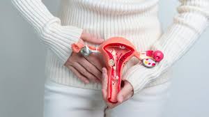 हिस्टेरेक्टॉमी (बच्चेदानी निकालने की सर्जरी) के बाद पेल्विक फ्लोर को मजबूत करना