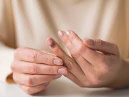 उंगली का दरवाजे में दबना (Crush Injury) तुरंत राहत के उपाय।