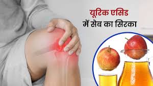 एप्पल साइडर विनेगर क्या सेब का सिरका यूरिक एसिड और जोड़ों का दर्द कम करता है