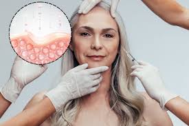 कोलेजन (Collagen)क्या कोलेजन सप्लीमेंट्स सच में जोड़ों और कार्टिलेज के लिए फायदेमंद हैं