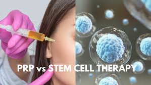 क्या स्टेम सेल थेरेपी (Stem Cell Therapy) और पीआरपी (PRP) के बाद फिजियोथेरेपी के बिना पूरा फायदा मिल सकता है?